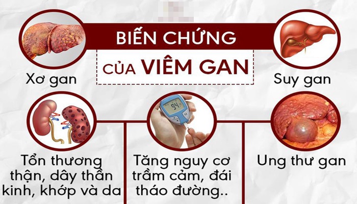 Biến chứng nguy hiểm của bệnh viêm gan