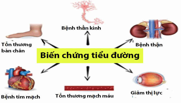 diagood2 Biến chứng bệnh tiểu đường (ảnh internet)