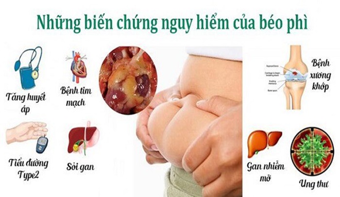 Những biến chứng nguy hiểm của béo phì