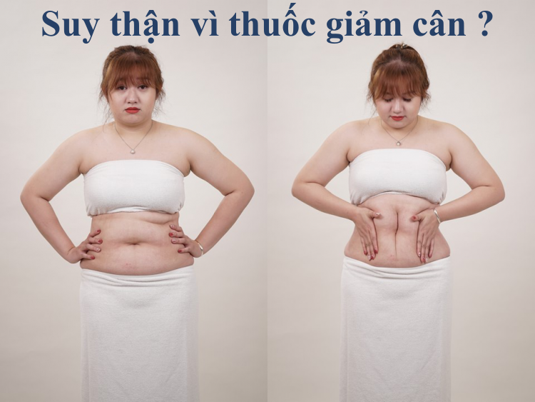 suy-than-vi-uong-thuoc-giam-can