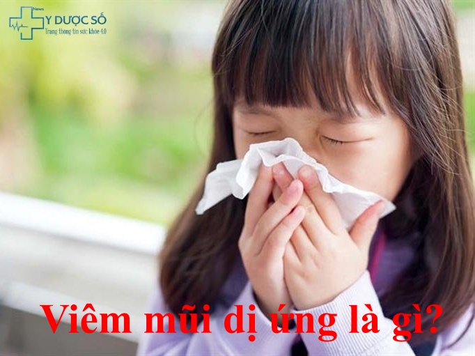 vic3aam-mc5a9i-de1bb8b-e1bba9ng-lc3a0-gc3ac Viêm mũi dị ứng là gì?